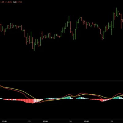 Trading Smarter With Indicators: How to Use the Best MACD Settings for Consistent Results
